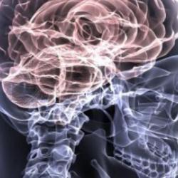 Traumatic Brain Injuries Due to Someone Else’s Negligence